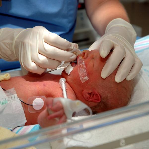 Neonatal Infusion Therapy: Reducing the Risks of Complications